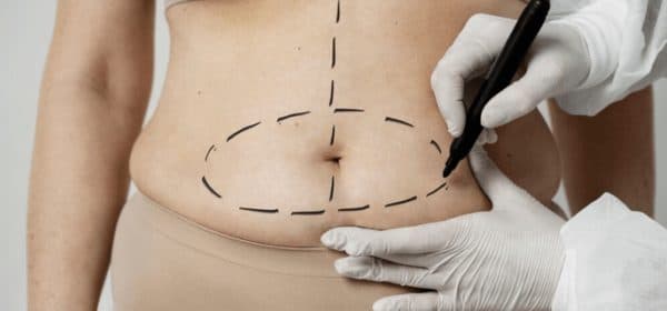 Zabieg i Opieka Pozabiegowa