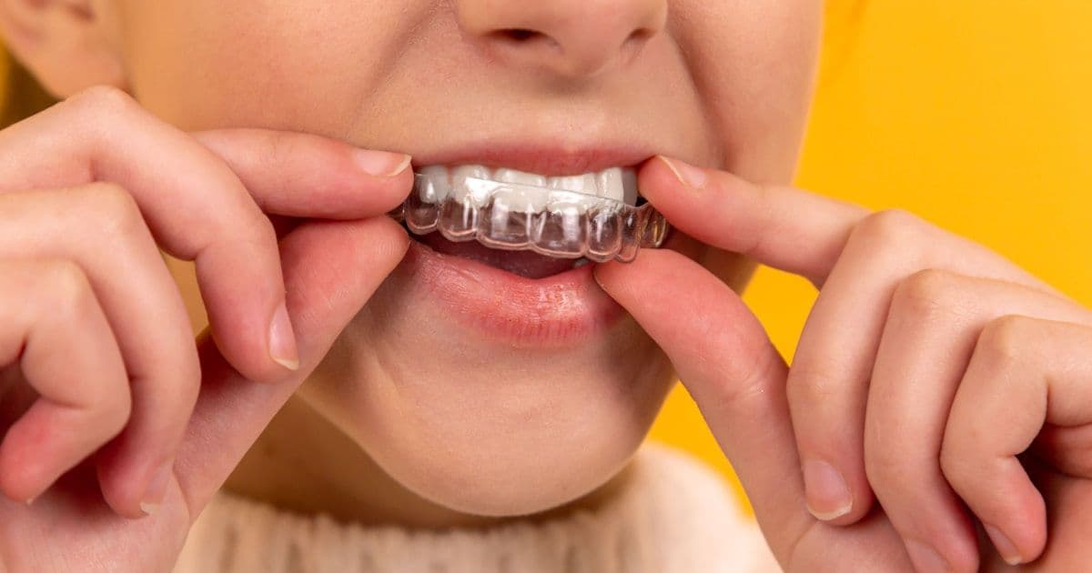 Root Canal Therapy: What to Expect During Treatment