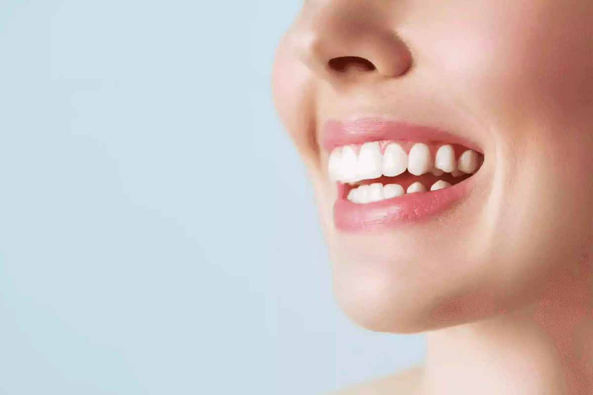 Hollywood Gülüşü in Istanbul — Estetica Istanbul