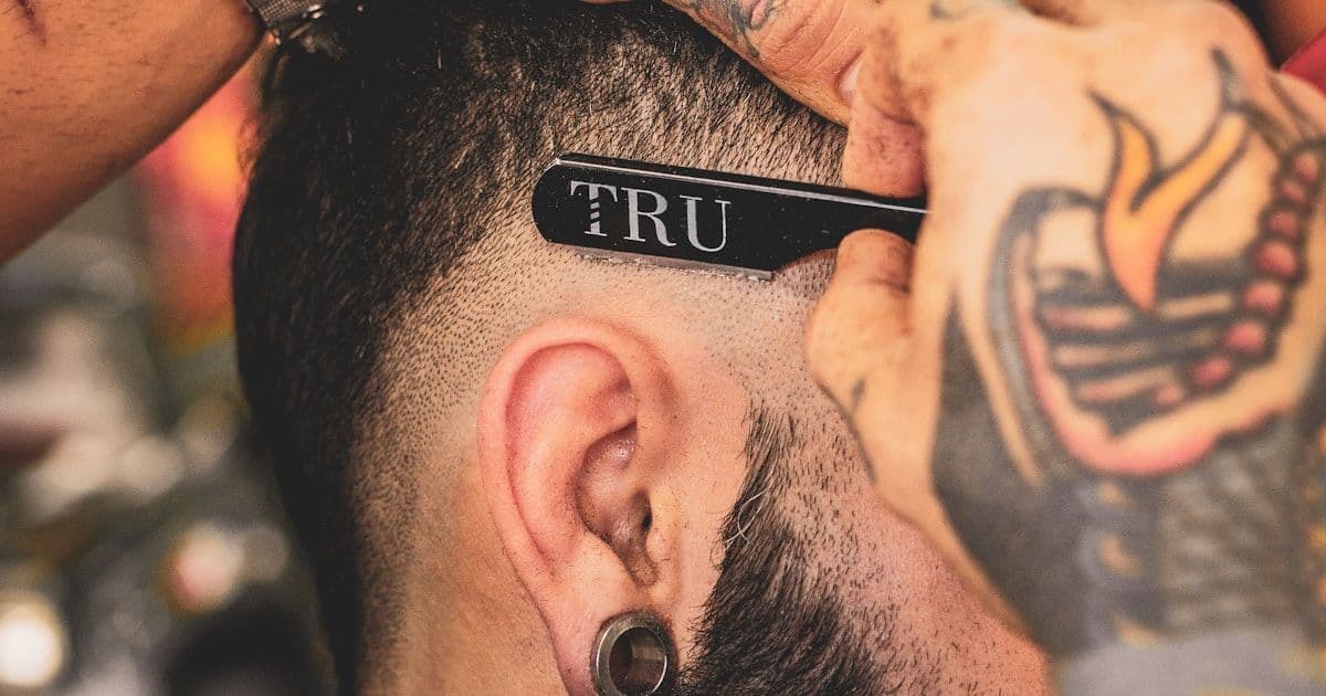 Is Hair Transplantation Permanent?