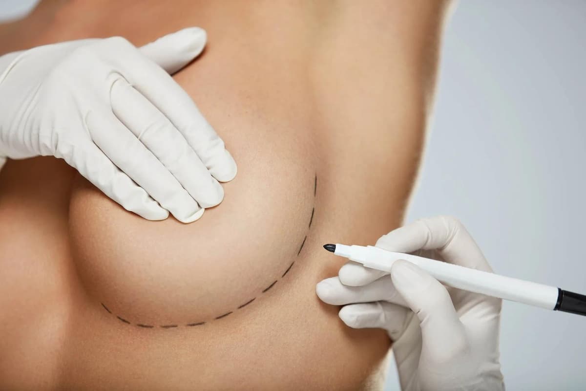 Augmentation Mammaire in Istanbul — Estetica Istanbul