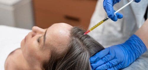 Saç Dökülmesinin Nedenleri ve Belirtileri