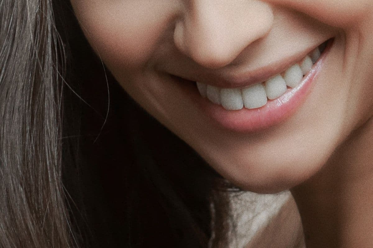 Diş Kaplamaları Ne Kadar Tutar? Tam Fiyat Karşılaştırması: Türkiye vs İngiltere vs Almanya (2026)