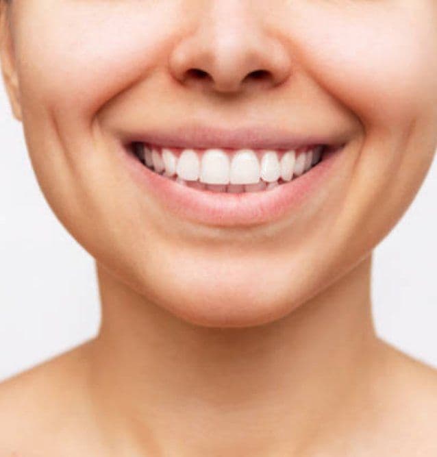 Gülümseme Tasarımı: Danışmanlıktan Nihai Sonuca