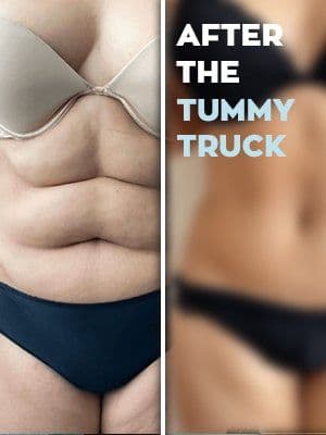 Tummy Truck Before After