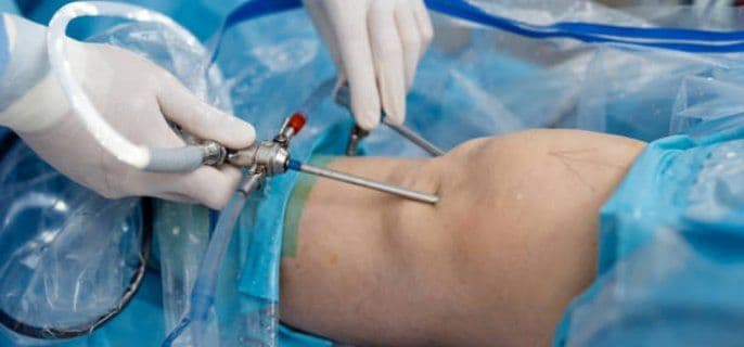 Brezilya Popo Estetiği (BBL)